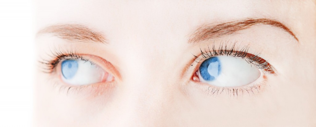 Tips for Patients Considering Eyelid Surgery