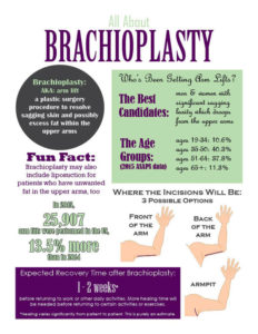 All About Brachioplasty surgery - dr franklyn elliott