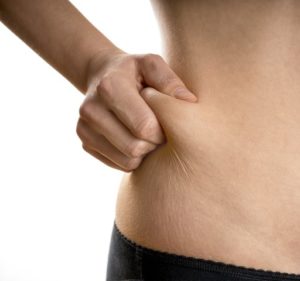 What Liposuction Can and Can Not Do