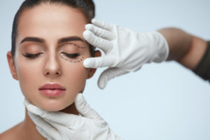 Ask Dr. Elliott Common Questions About Eyelid Surgery