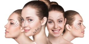 What You Should Know About Recent Plastic Surgery Statistics