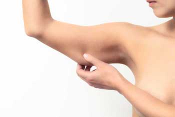 woman-pulls-skin-under-arm